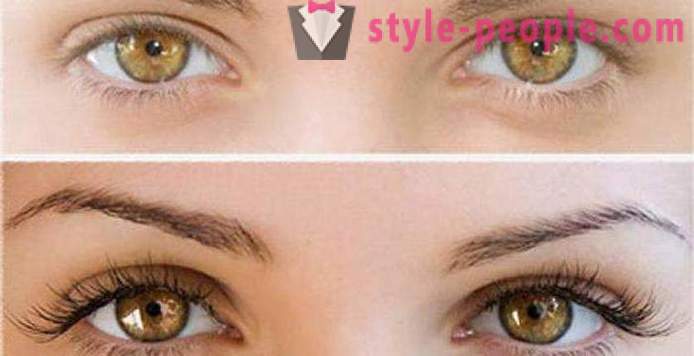 Vad är Botox ögonfransar? Foton före och efter, särskilt förfaranden
