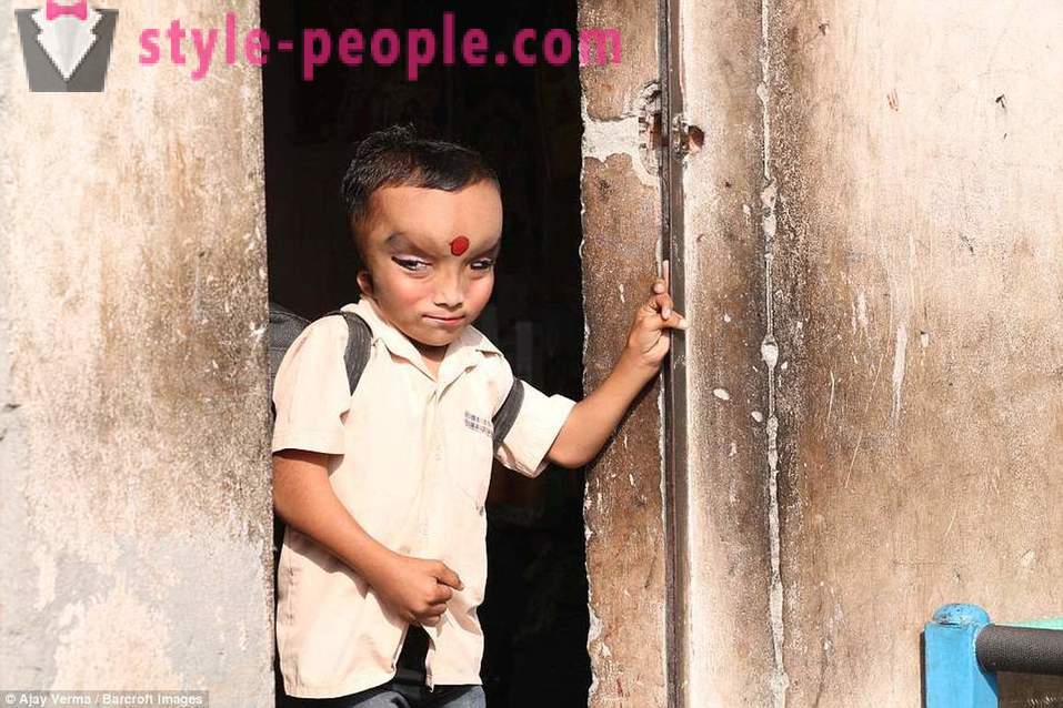 Den indiska byn dyrkas pojke med en deformerad huvud som en gud Ganesha